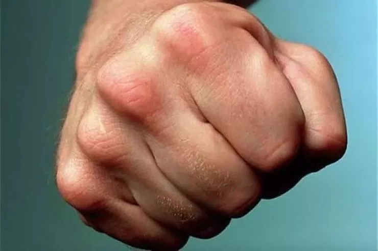 IMG