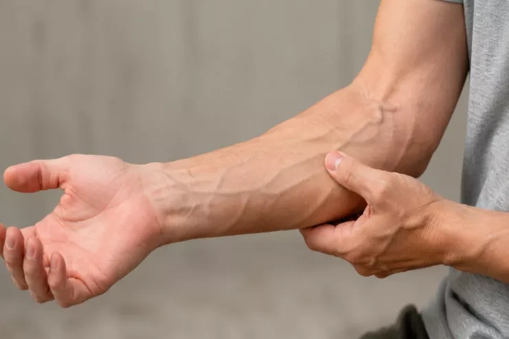 IMG